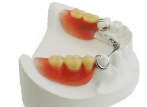 Partial denture being fit to a model of patient's mouth.